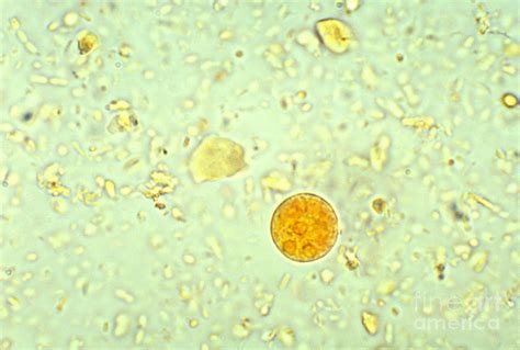 Entamoeba Histolytica Cyst Photograph By Science Source Sexiz Pix