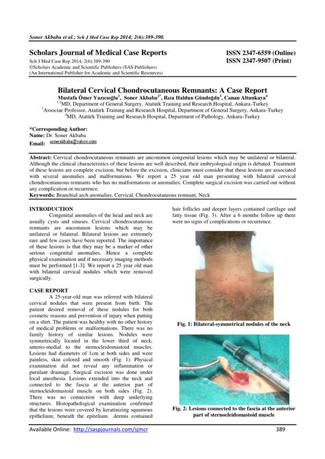 Pdf Bilateral Cervical Chondrocutaneous Remnants A Case Report