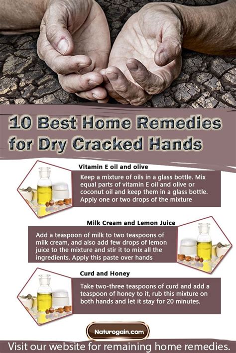 10 best home remedies for dry cracked hands dry cracked hands cracked hands cracked hands remedy