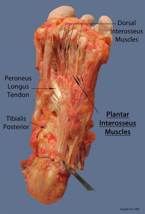 Learn about anatomy muscles foot plantar with free interactive flashcards. Plantar interossei (LPN) - Anatomy - Medbullets Step 1