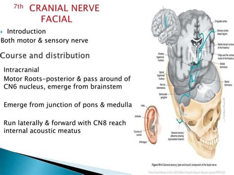 Multiple Cranial Nerve Palsy Final Ppt