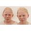 Identical Twins Are Genetically Different Research Suggests  Daily