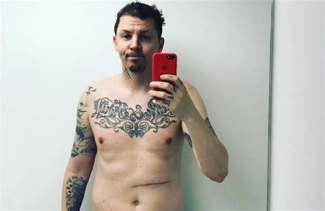 Professor Green Posts Shirtless Instagram Pic After Botched Surgery