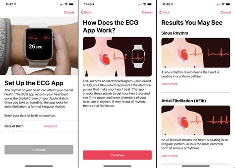 How To Use The Ecg Feature On Apple Watch Series 4 Macworld