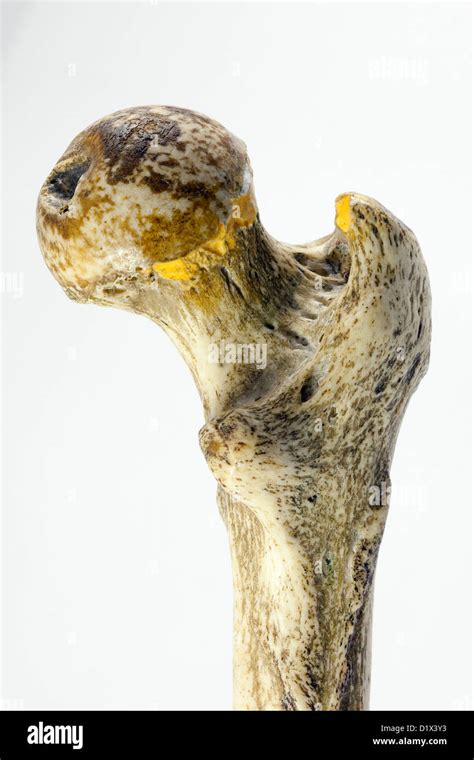 Real Human Bones Hi Res Stock Photography And Images Alamy