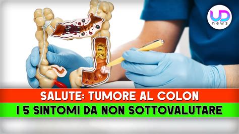 Tumore Al Colon 5 Sintomi Da Non Sottovalutare