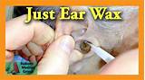 Images of Ear Wax Doctor