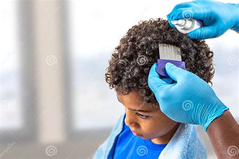 Looking For Lice On Childs Head Stock Image Image Of Child Dandruff