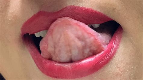 Bite Dentale Benefici E Controindicazioni Risponde Lodontoiatra My Xxx Hot Girl