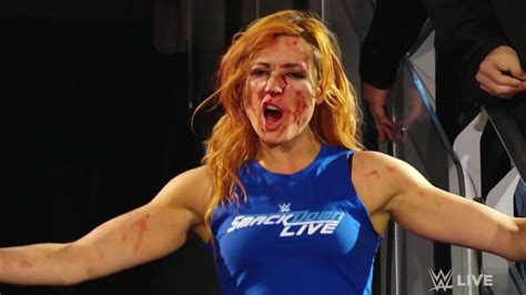 One Year Ago Today Becky Lynch Leads The Smackdown Womens Division In An Invasion Of Raw Six