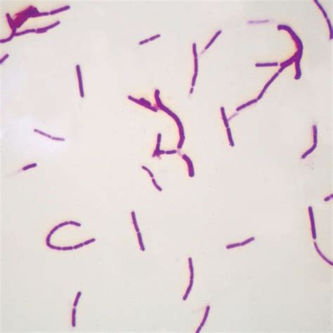 Buy Bacillus Subtilis Wm Microscope Slide Online At Low Prices In