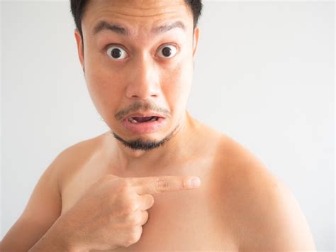 premium photo asian man get ugly tanned on the shoulder