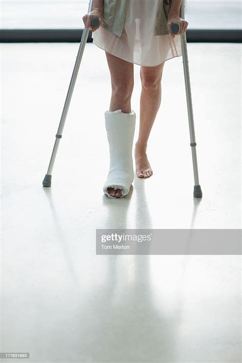 Person With Cast On Leg Using Crutches Bildbanksbilder Getty Images