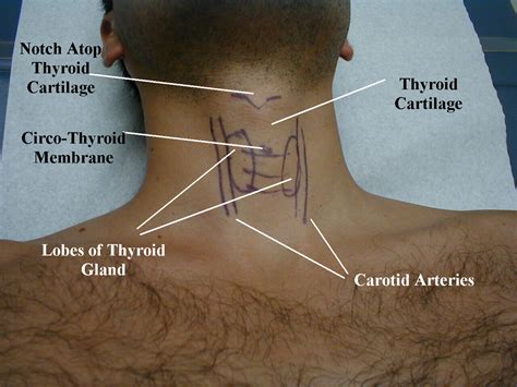 Lymph Node Back Of Neck Anatomy Multiple Sclerosis The Vascular