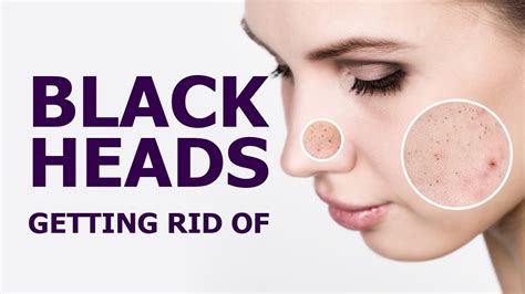 Easy Ways To Get Rid Of The Blackheads Youtube