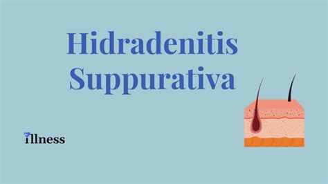 Hidradenitis Suppurativa Overview Causes Symptoms Treatment