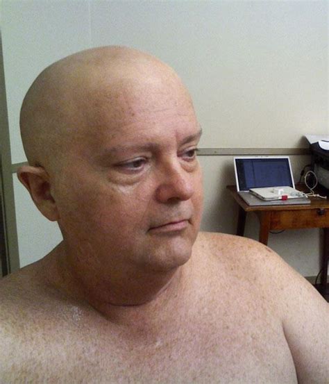 Bald Cap Wikipedia