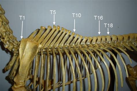 The thoracic vertebrae