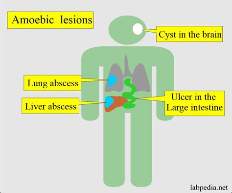 Amoebiasis Entamoeba Histolytica Life Cycle Diagnosis Labpedia Net