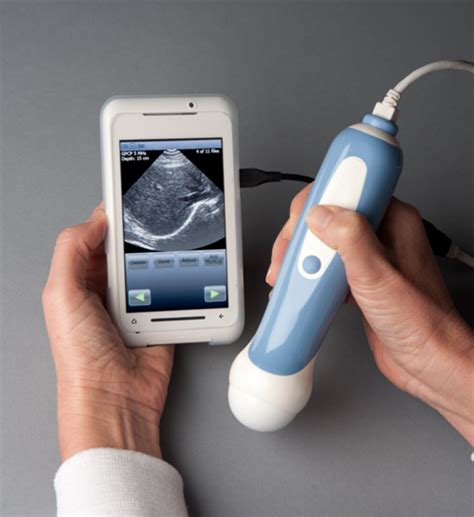 Die funktionsweise ist so simpel wie effektiv: MobiUS SP1 morphs Toshiba TG01 into a portable ultrasound ...