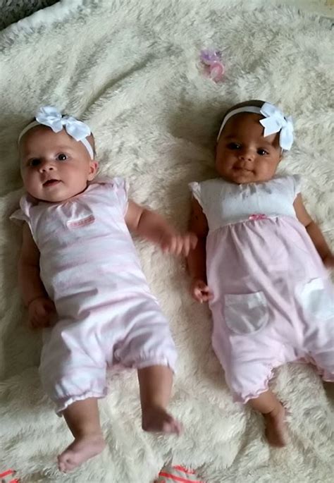 These Black And White Babies Are Twins But Nobody Believes They Are