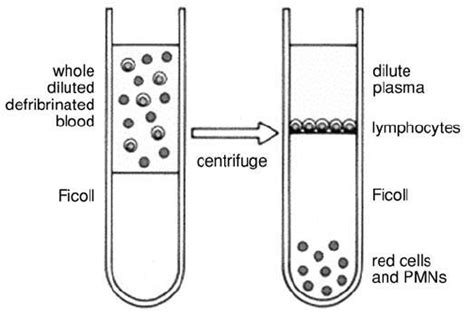 After the centrifugation step, ficoll separates layers of blood, with lymphocytes and monocytes under a layer of plasma. Ficoll gradient separation of mononuclear cells from ...
