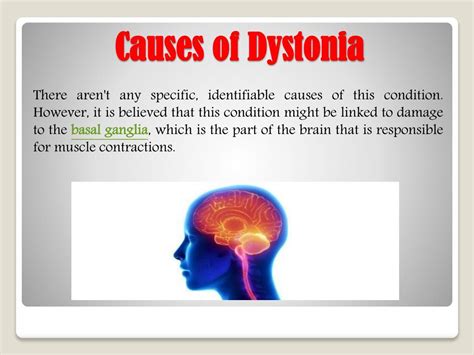 Ppt Dystonia Causes Types Symptoms And Treatments Powerpoint Hot Sex