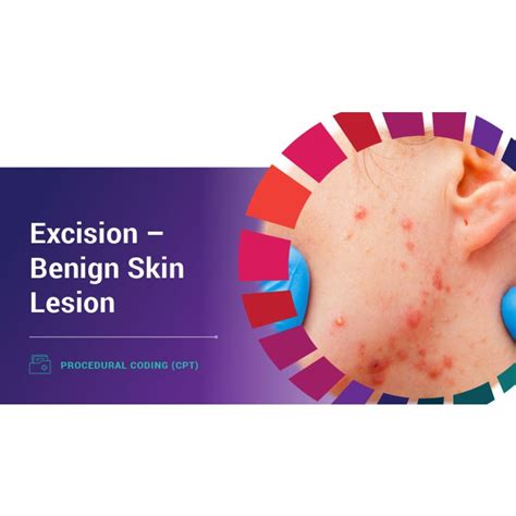 Benign Skin Lesions Ph