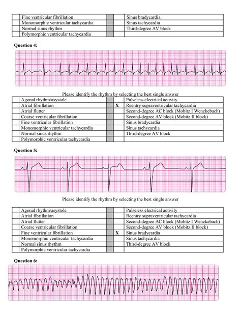 Acls Test Answers Version E Bethltor