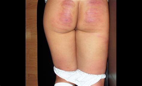 Keira Knightley Nude Spanked Real Hard Spankings Otk