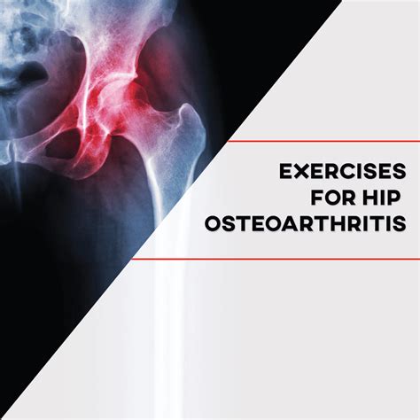 Exercises For Hip Osteoarthritis P Rehab
