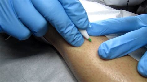 Laser hair removal this is a less painful substitute to electrolysis and for some people, may result in permanent hair removal. Permanent Hair Removal, Electrolysis - YouTube
