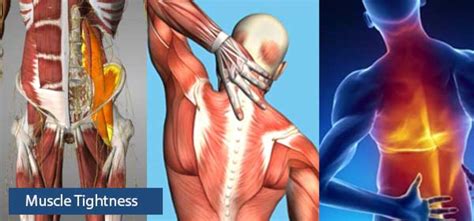 Tight Muscles 9 Causes Of Muscle Tightness