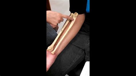 How To Differentiate The Ulna And The Radius Bones In A