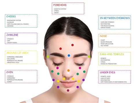 Acne Face Map Detailed Poster Size 24x18 Etsy