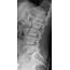 Low Back Pain – Undergraduate Diagnostic Imaging Fundamentals