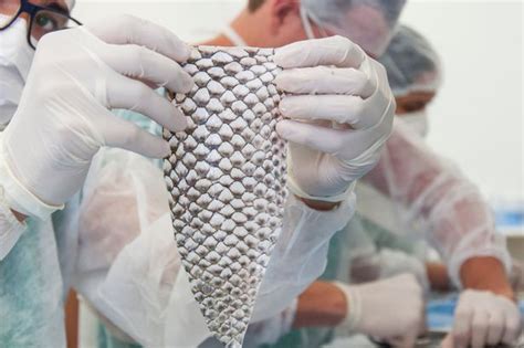 Trans Woman 35 First In World To Get Vagina Made Out Of Fish Skin