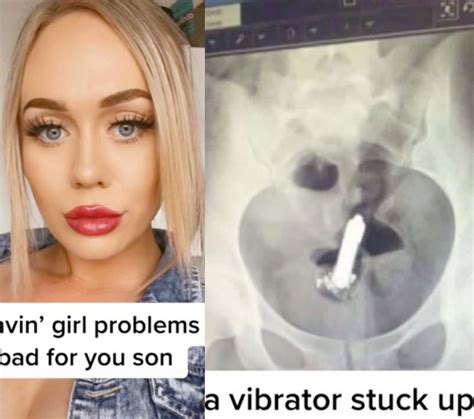 Woman Tells Of Her Embarrassment After Vibrator Got Stuck Up Her Bum And She Needed Surgery To