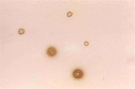 Mycoplasma Bacterium Genus