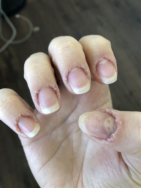 Any Suggestions With Biting The Cuticles 😔 Rcalmhands