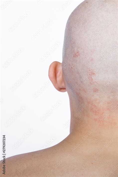 foto stock bald head of a man on a white background body part the head concept brain