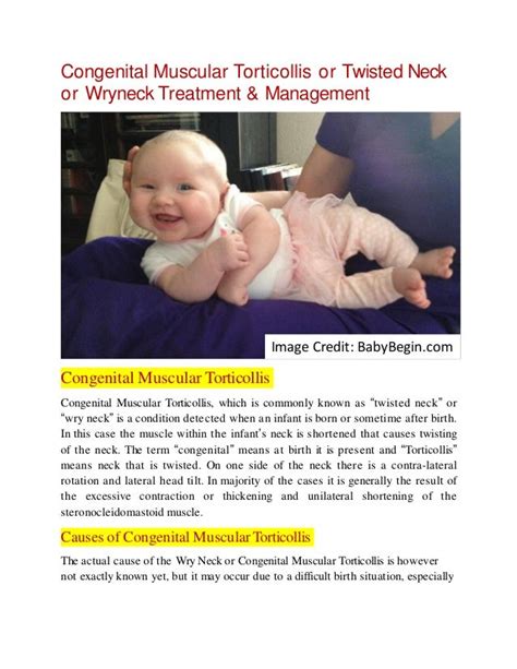 congenital muscular torticollis or twisted neck or wryneck treatment