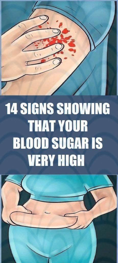 14 Signs Showing That Your Blood Sugar Is Very High High Blood Sugar