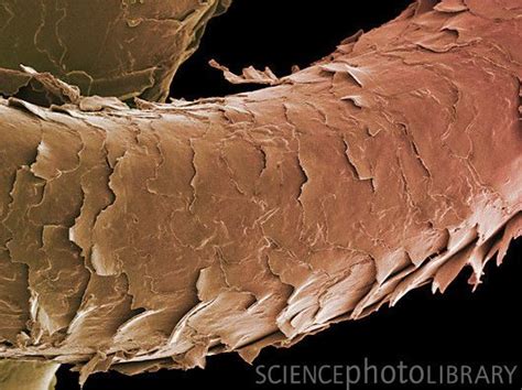 What Does Damaged Hair Look Like Under A Microscope Normand Garnett