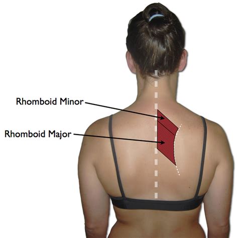Rhomboid Trigger Points A Pain Between The Shoulder Blades