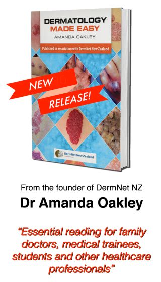 Dermatology Made Easy Dermnet New Zealand