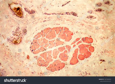 Skin Human Show Sweat Gland Microscopy Stock Photo 1007360920