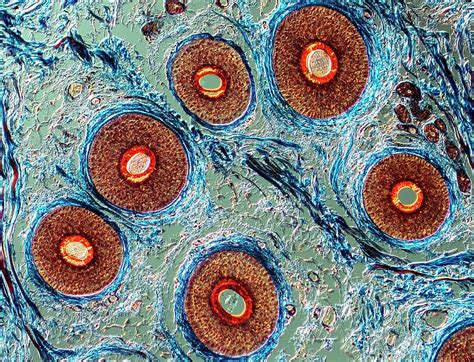 Cross Section Through Human Hairs Photograph By Alfred Pasieka