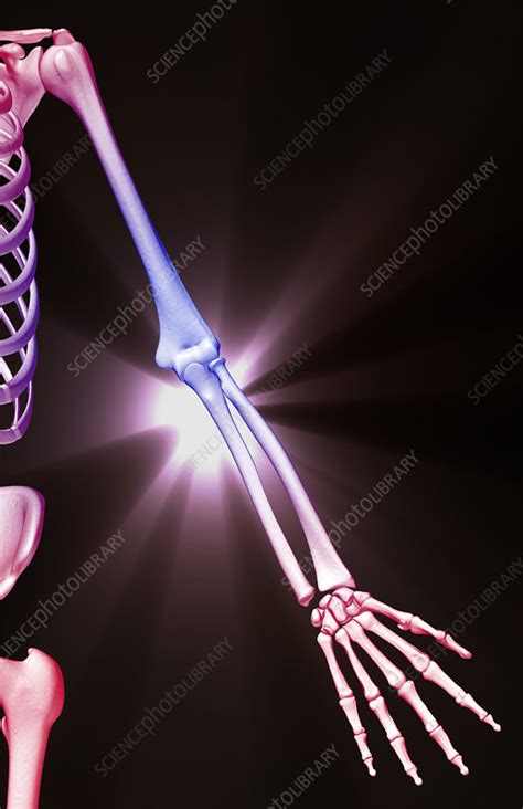 The Bones Of The Upper Limb Stock Image F0019224 Science Photo