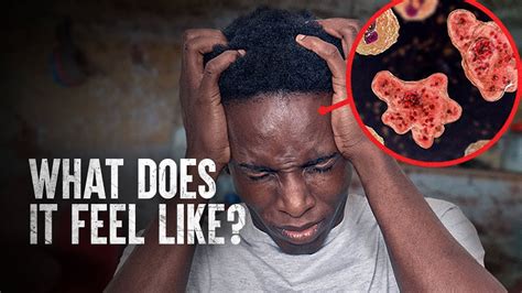 How To Survive A Brain Eating Amoeba Youtube